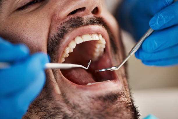 Best Broken or Chipped Tooth Repair in Willmar, MN